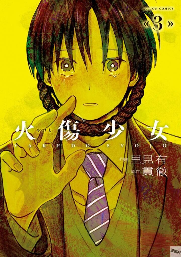 Yakedo Shoujo Chapter 15 - Trang 1
