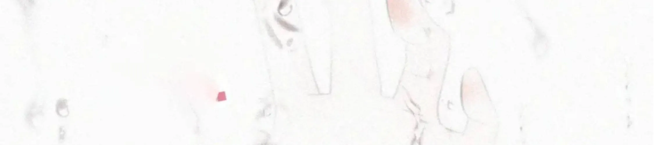 Bá Vương Sủng Ái Cô Vợ Mù Chap 170 - Next Chap 171